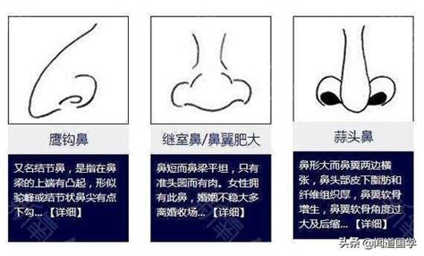 鼻樑 面相|面相學之鼻型解析、全面解讀鼻子與命運